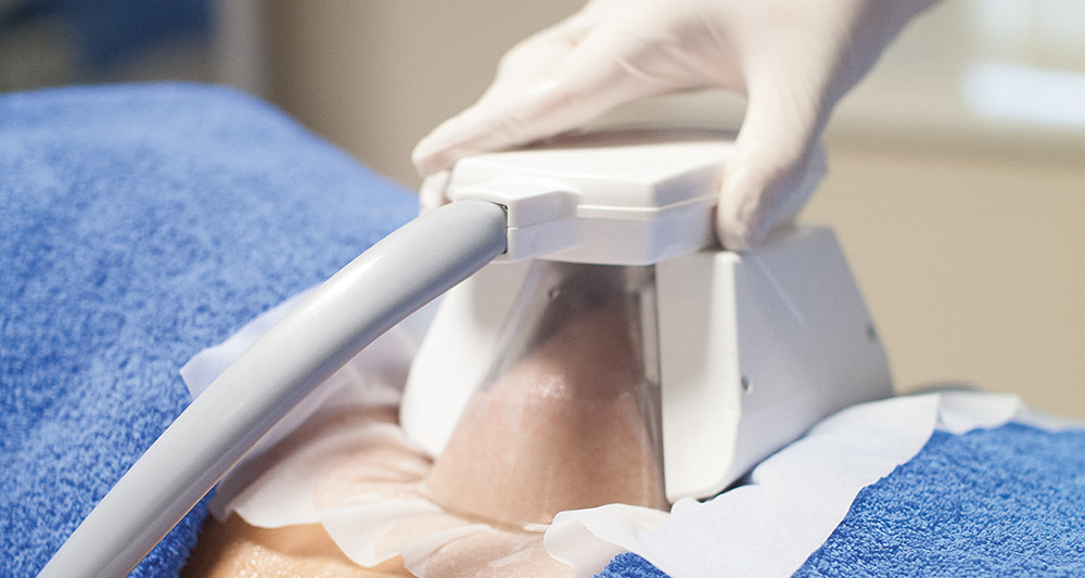 How Fat Freezing and HIFU Work Together? 2 Multiple Areas in One Session HIFU and Fat Freezing Virginia Water