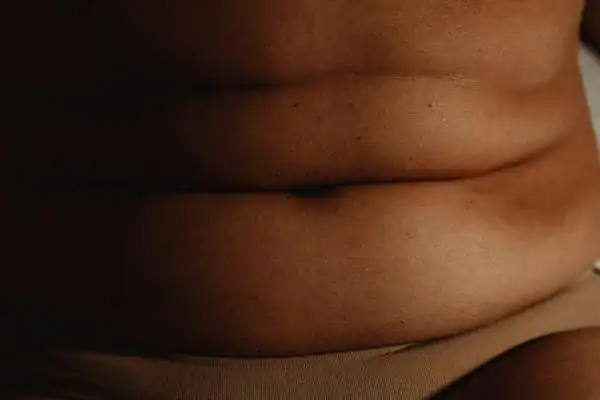 The Hidden Connection: How Stress Shapes Your Fitness and Body Composition 3 image of what stress can do on the stomach area and how Lipo 360 Virginia Water can help to change your body shape.